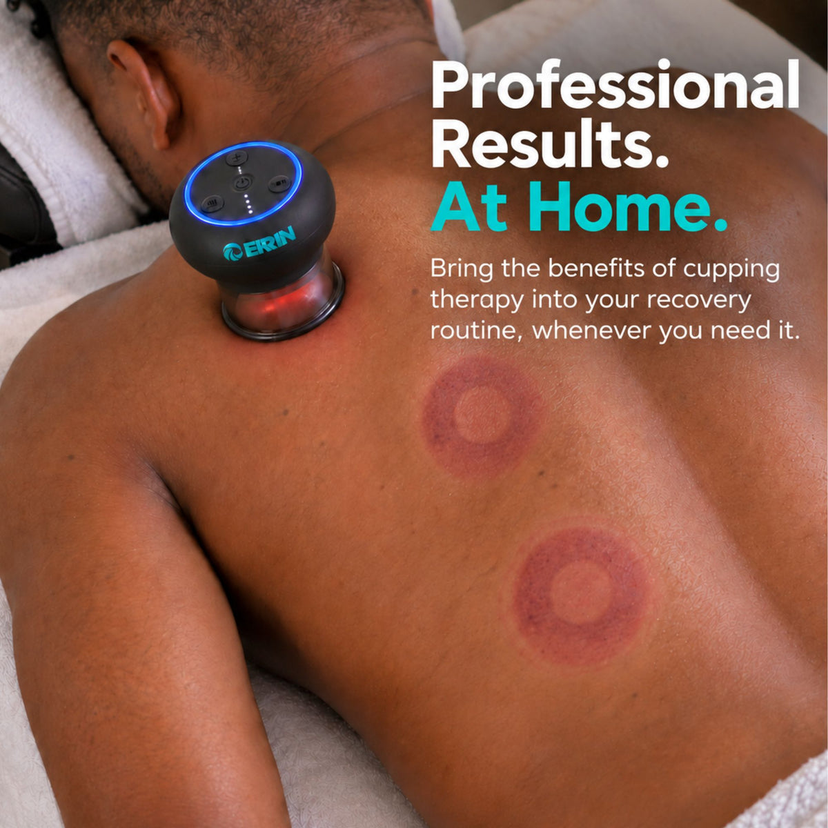 Ekrin Hummingbird Electric Cupping Massager